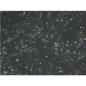 SKHEP-1 Cells#人肝癌细胞系种子库|完全培养基|STR图谱