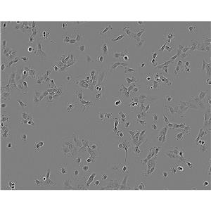 HUCCT1 Cells#人膽管癌細(xì)胞系種子庫(kù)|完全培養(yǎng)基|STR圖譜,HUCCT1 Cells#