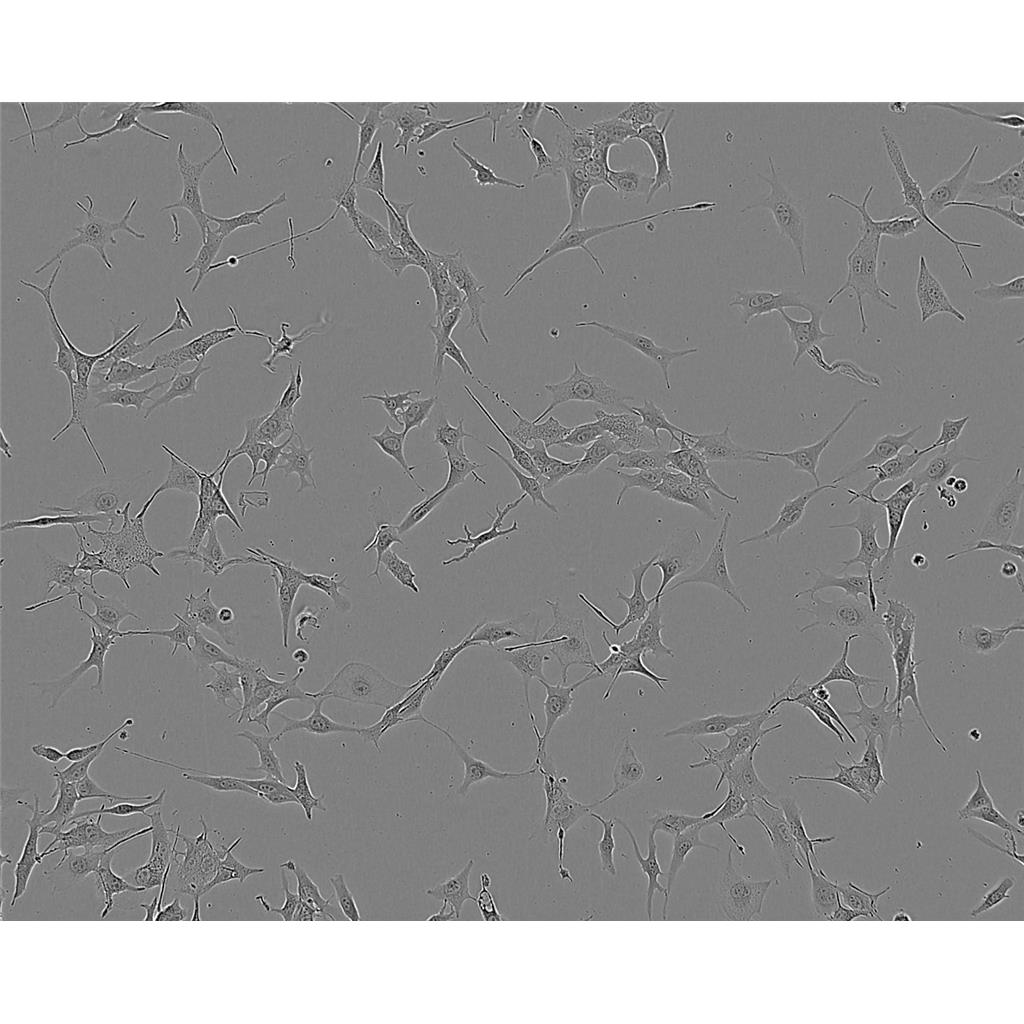 SW.620 Cells#人結(jié)腸癌細胞系種子庫|完全培養(yǎng)基|STR圖譜,SW.620 Cells#