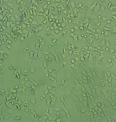 SW 982 Cells#人滑膜肉瘤细胞系种子库|完全培养基|STR图谱,SW 982 Cells#