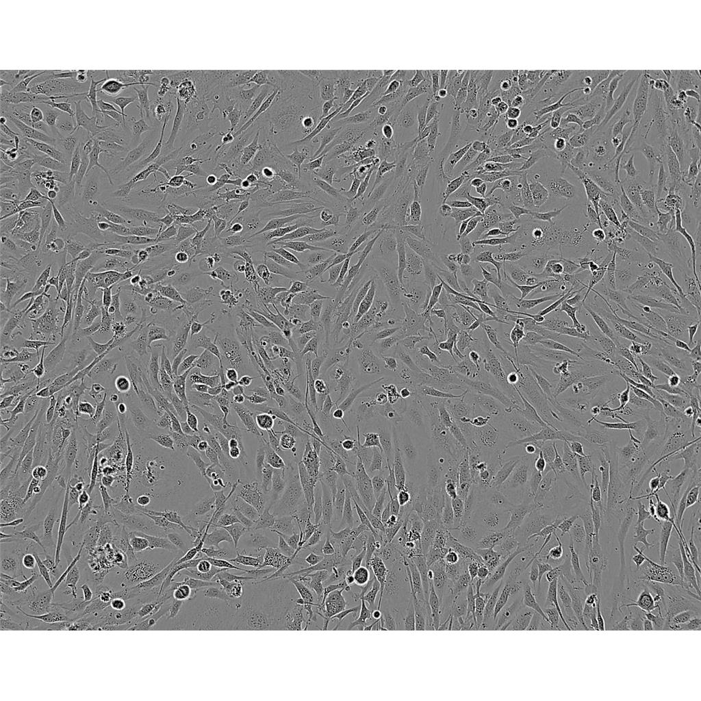 RPMI2650 Cells#人鼻腔上皮細(xì)胞系種子庫|完全培養(yǎng)基|STR圖譜,RPMI2650 Cells#