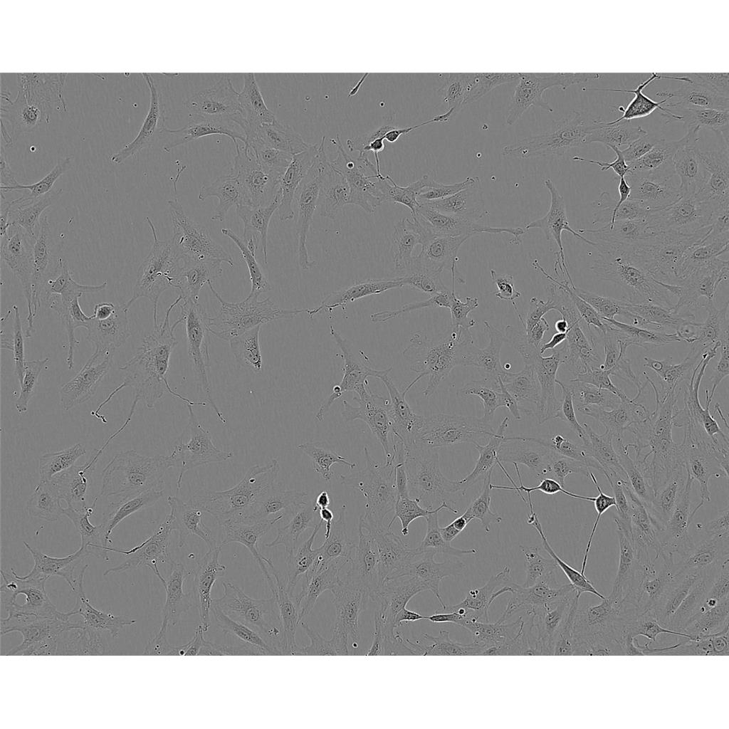 KYSE30 Cells#人食道癌細(xì)胞系種子庫|完全培養(yǎng)基|STR圖譜,KYSE30 Cells#