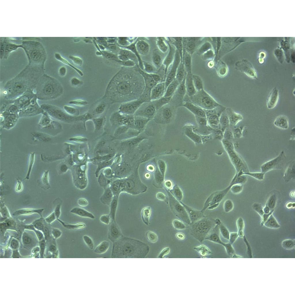 SK.OV.3 Cells#人卵巢癌細胞系種子庫|完全培養(yǎng)基|STR圖譜,SK.OV.3 Cells#