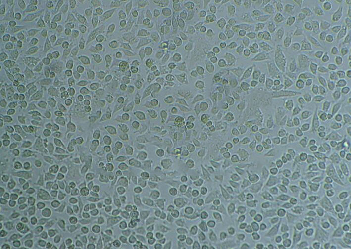 SW 1116 Cells#人結(jié)腸癌細(xì)胞系種子庫(kù)|完全培養(yǎng)基|STR圖譜,SW 1116 Cells#