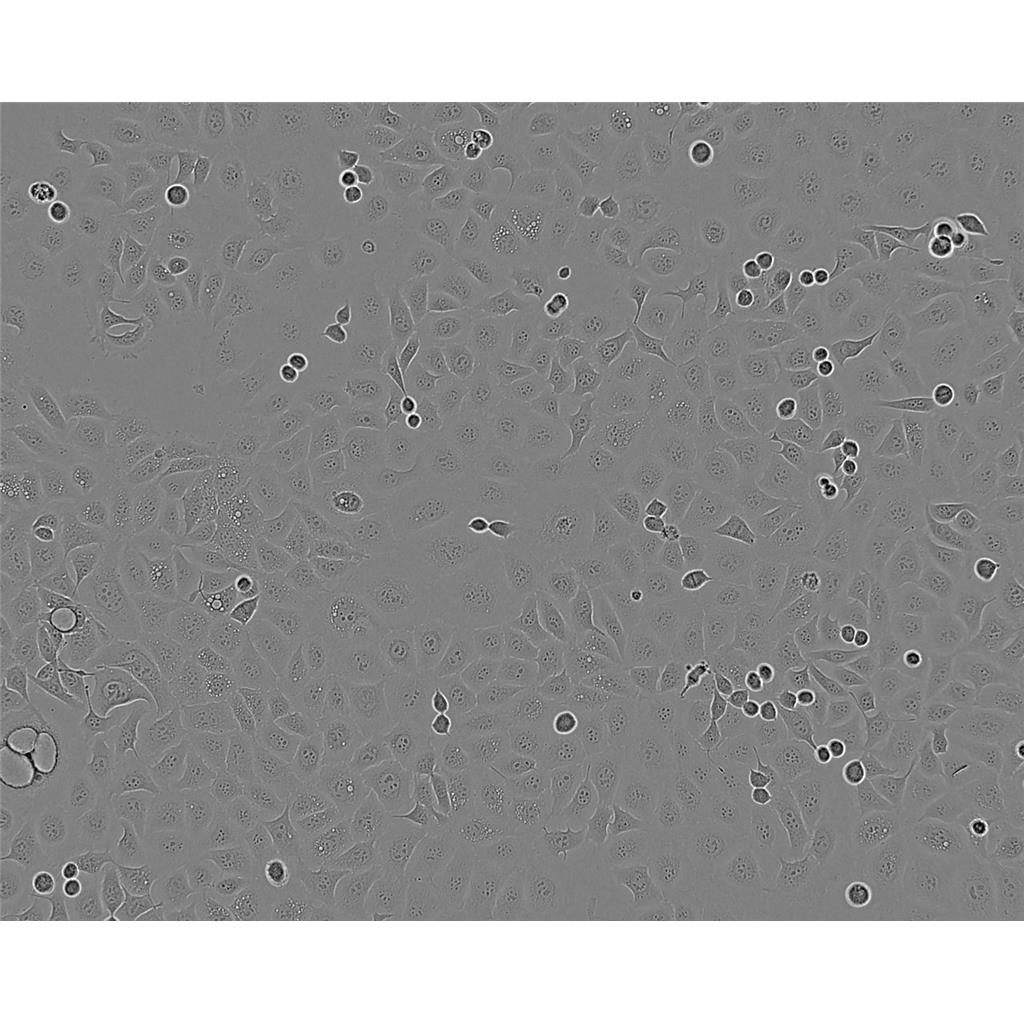 mdamB415 Cells#人乳腺腺癌細胞系種子庫|完全培養(yǎng)基|STR圖譜,mdamB415 Cells#