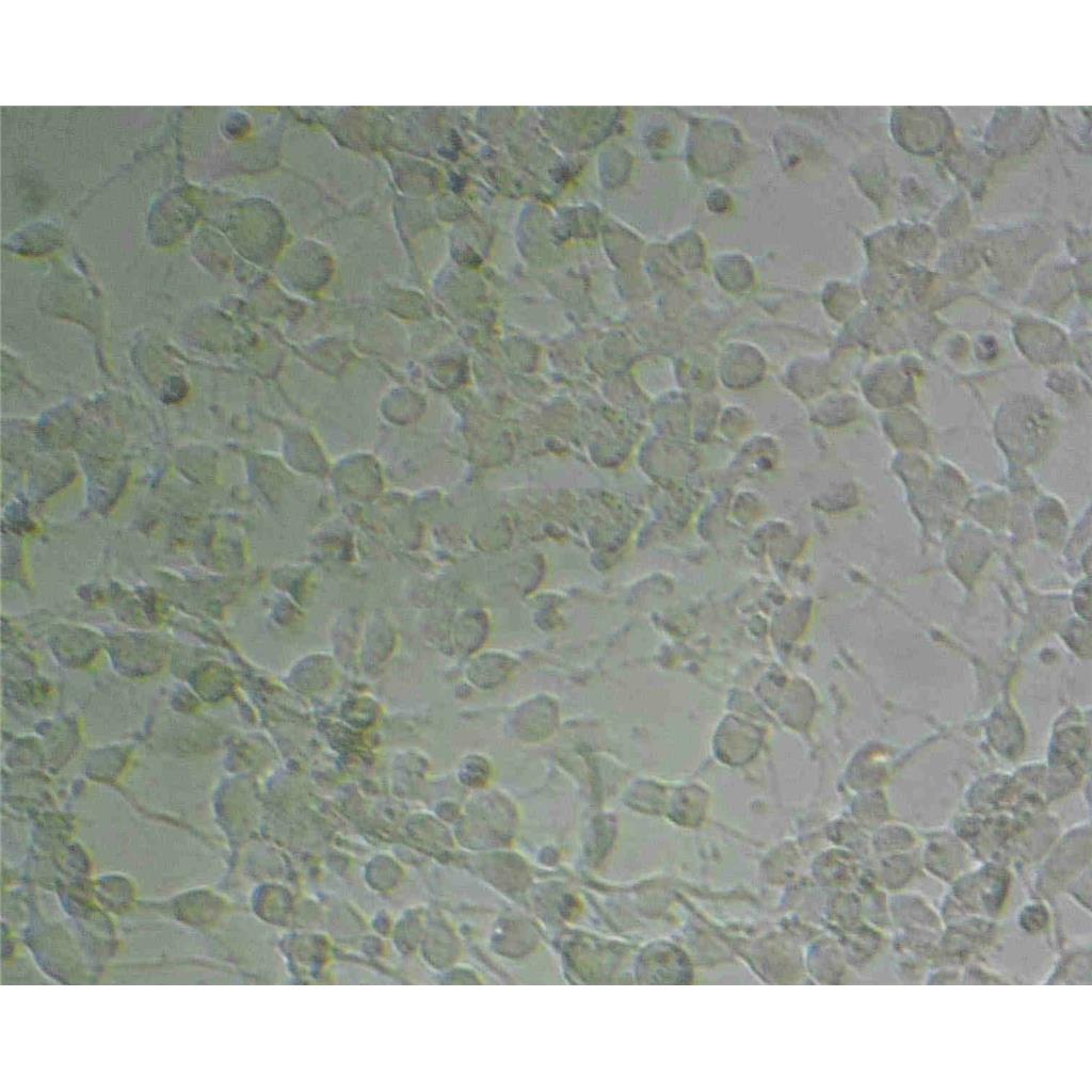 SW 480 Cells#人結(jié)腸癌細(xì)胞系種子庫|完全培養(yǎng)基|STR圖譜,SW 480 Cells#