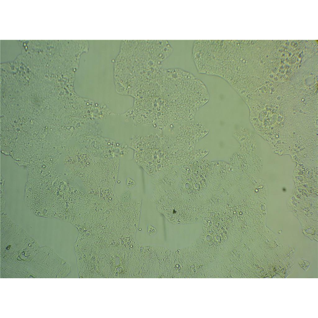 CT-26 Cells#小鼠結(jié)腸癌細(xì)胞系種子庫|完全培養(yǎng)基|STR圖譜,CT-26 Cells#