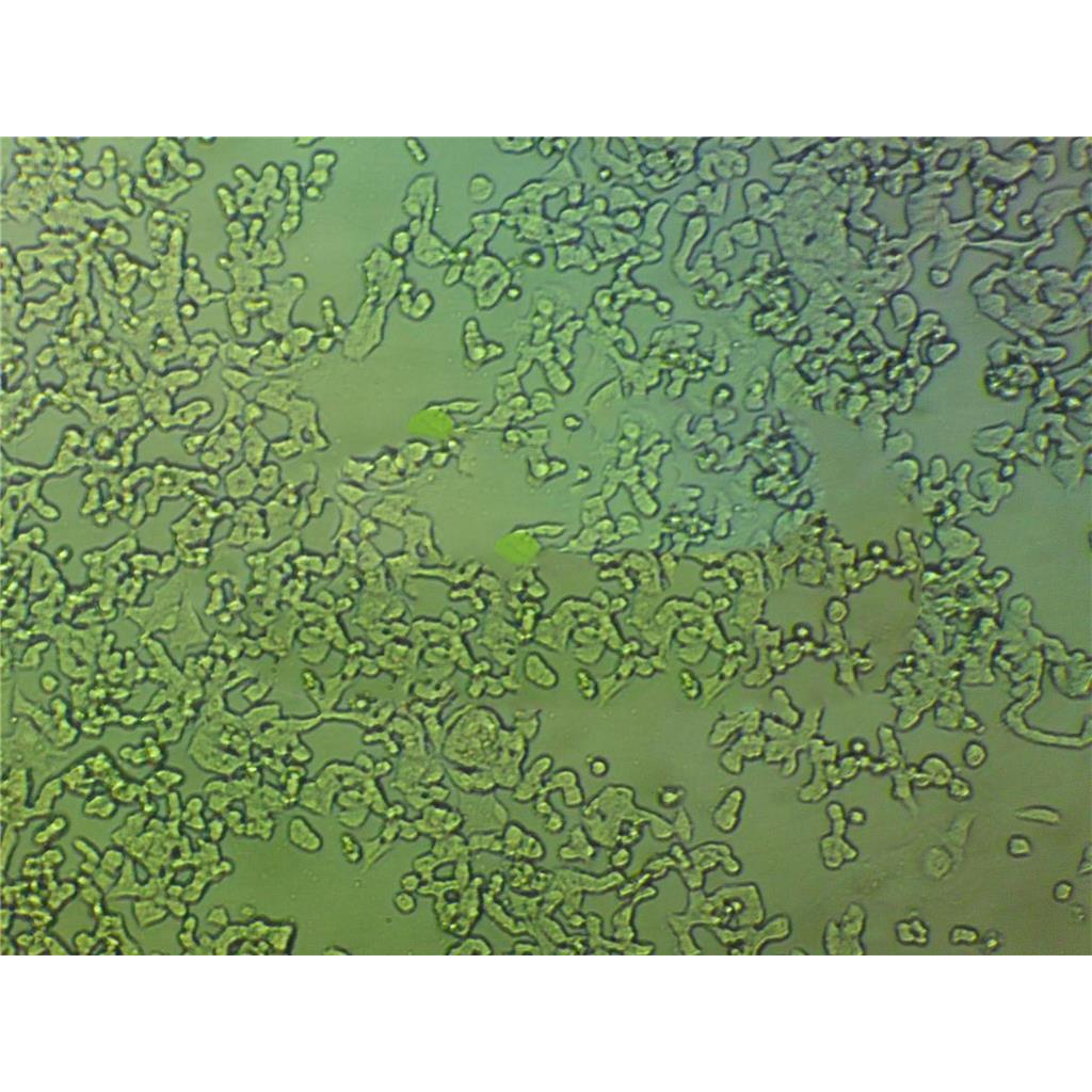 JurkatE6-1 Cells#人急性T淋巴細(xì)胞系種子庫(kù)|完全培養(yǎng)基|STR圖譜,JurkatE6-1 Cells#