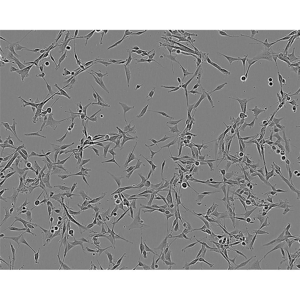 SKOV-3 Cells#人卵巢癌細(xì)胞系種子庫(kù)|完全培養(yǎng)基|STR圖譜,SKOV-3 Cells#