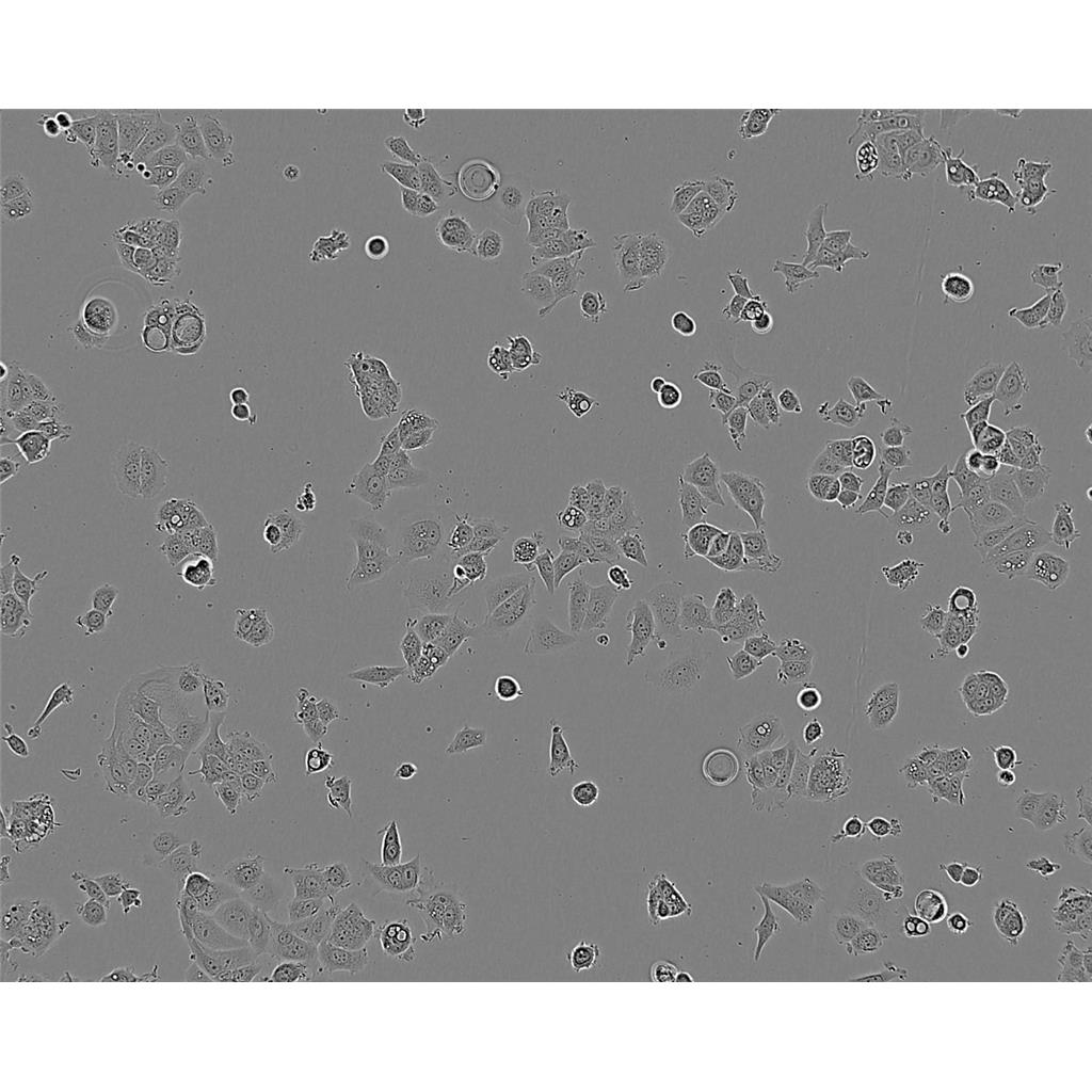 BC-PAP Cells#人甲狀腺癌乳頭狀細(xì)胞系種子庫|完全培養(yǎng)基|STR圖譜,BC-PAP Cells#