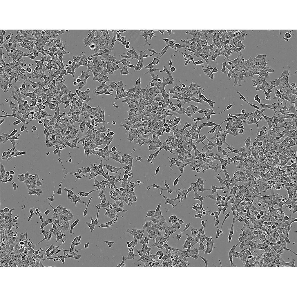 H1299 Cells#人非小細(xì)胞肺癌細(xì)胞系種子庫(kù)|完全培養(yǎng)基|STR圖譜,H1299 Cells#