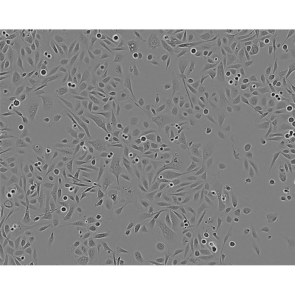 mda-MB 231 Cells#人乳腺癌細(xì)胞系種子庫|完全培養(yǎng)基|STR圖譜,mda-MB 231 Cells#