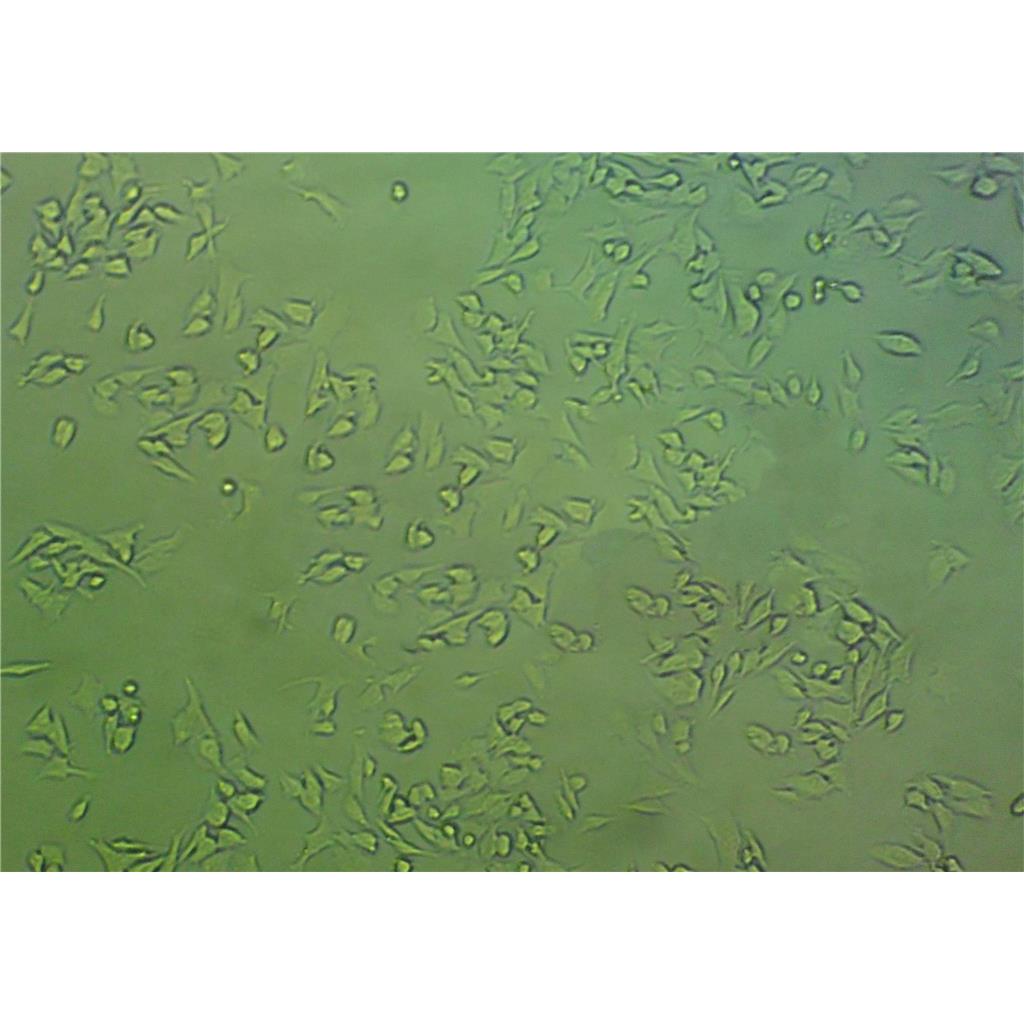 mda-MB415 Cells#人乳腺腺癌細(xì)胞系種子庫|完全培養(yǎng)基|STR圖譜,mda-MB415 Cells#