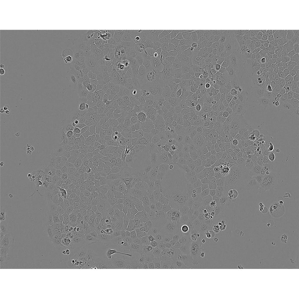 J774A1 Cells#小鼠單核巨噬細胞系種子庫|完全培養(yǎng)基|STR圖譜,J774A1 Cells#