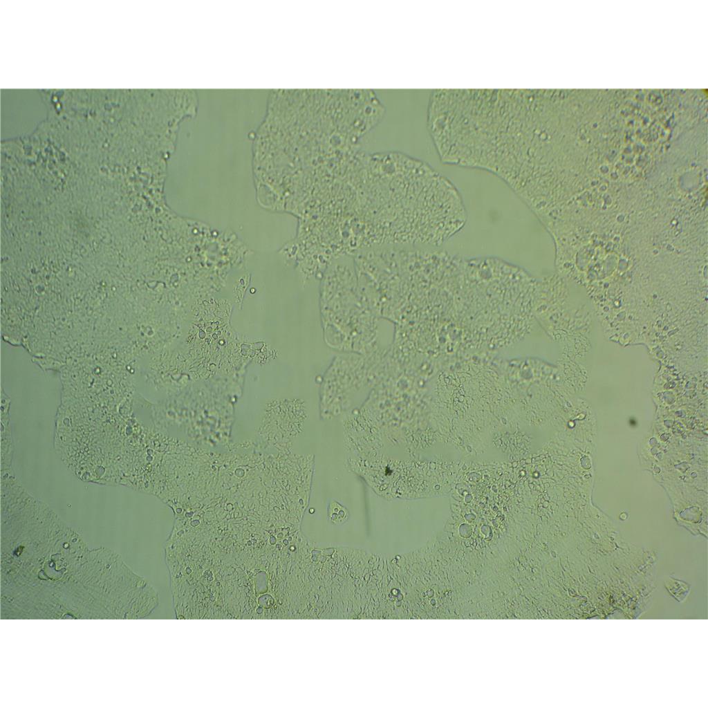 CT26 Cells#小鼠結(jié)腸癌細(xì)胞系種子庫(kù)|完全培養(yǎng)基|STR圖譜,CT26 Cells#