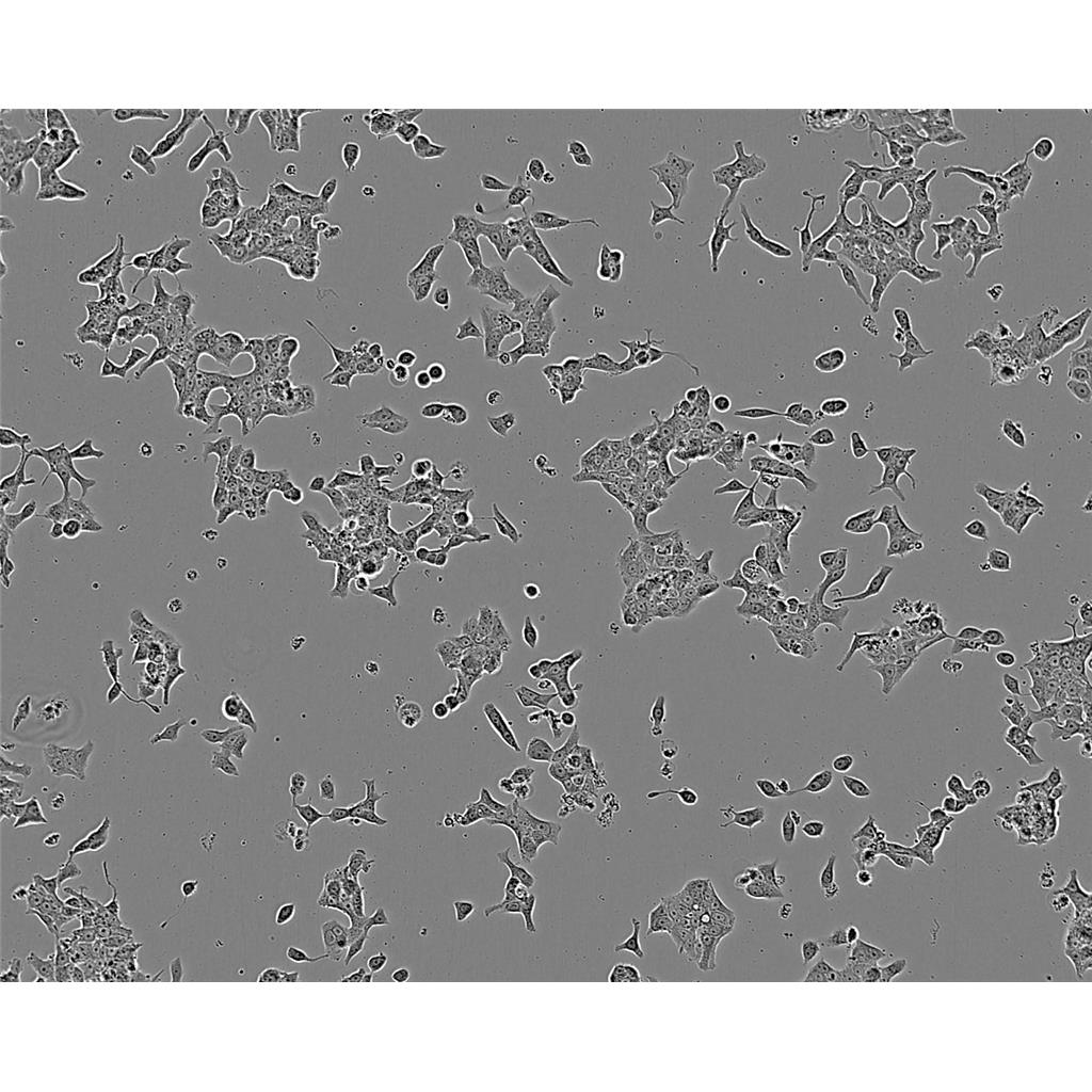 Hep-G2 Cells#人肝癌細(xì)胞系種子庫|完全培養(yǎng)基|STR圖譜,Hep-G2 Cells#