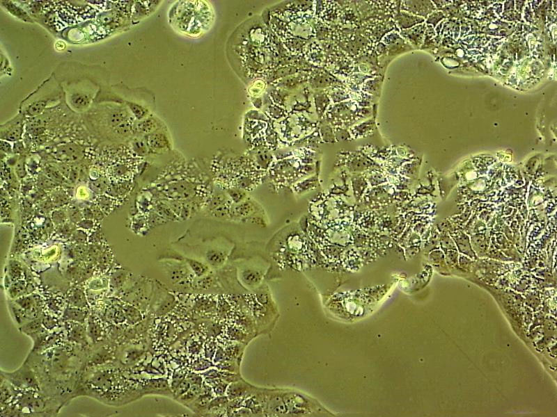 NCI-H2452 Cells#人間皮瘤細(xì)胞系種子庫(kù)|完全培養(yǎng)基|STR圖譜,NCI-H2452 Cells#