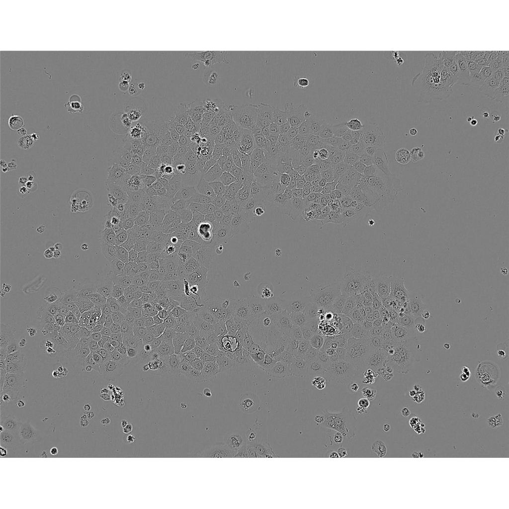 NCI-H209 Cells#人小細胞肺癌細胞系種子庫|完全培養(yǎng)基|STR圖譜,NCI-H209 Cells#