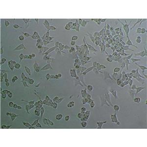 NCI-H441-4 Cells#人肺腺癌細(xì)胞系種子庫(kù)|完全培養(yǎng)基|STR圖譜,NCI-H441-4 Cells#