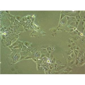 SKN-SH Cells#人神經(jīng)母細(xì)胞瘤細(xì)胞系種子庫(kù)|完全培養(yǎng)基|STR圖譜