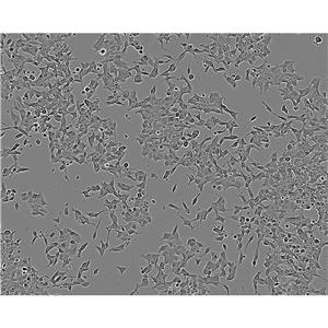 Mdck (NBL-2) Cells#犬腎細胞系種子庫|完全培養(yǎng)基|STR圖譜