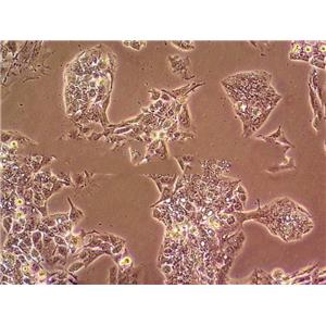 NCI H508 Cells#人結(jié)腸直腸腺癌細(xì)胞系種子庫|完全培養(yǎng)基|STR圖譜