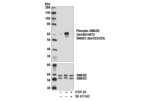 CST磷酸化SMAD2（Ser465/467）/SMAD3（Ser423/425）（D27F4）兔單克隆抗體,Phospho-Smad2 (Ser465/467)/Smad3 (Ser423/425) (D27F4) Rabbit mAb