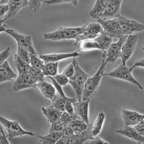 CAOV3 Cells#人卵巢癌細(xì)胞系活性強(qiáng)|培養(yǎng)基|送STR圖譜,CAOV3 Cells#