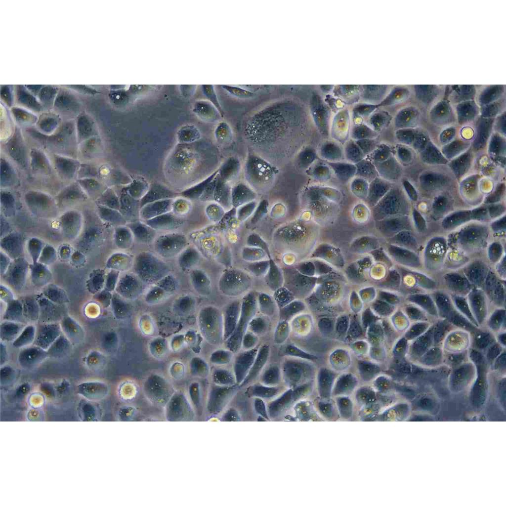 UMUC3 Cells#人膀胱移行癌細(xì)胞系活性強(qiáng)|培養(yǎng)基|送STR圖譜,UMUC3 Cells#