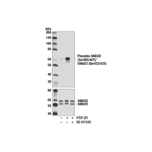 CST磷酸化SMAD2（Ser465/467）/SMAD3（Ser423/425）（D27F4）兔單克隆抗體