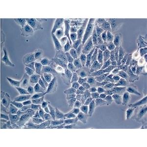 NCIH520 Cells#人肺腺鱗癌細(xì)胞系活性強(qiáng)|培養(yǎng)基|送STR圖譜