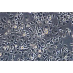 NCIH1395 Cells#人非小細(xì)胞肺癌細(xì)胞系活性強(qiáng)|培養(yǎng)基|送STR圖譜