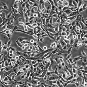 NCI-HUT-520 Cells#人肺腺鱗癌細(xì)胞系活性強(qiáng)|培養(yǎng)基|送STR圖譜