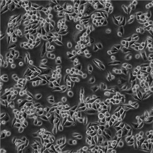 P3-X63-Ag8 Cells#小鼠骨髓瘤細(xì)胞系活性強(qiáng)|培養(yǎng)基|送STR圖譜