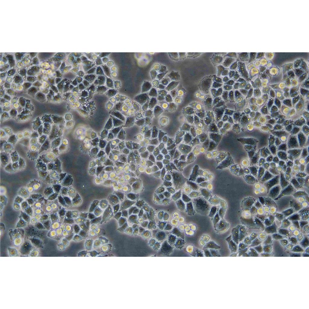 NCI H508 Cells#人結(jié)腸直腸腺癌細(xì)胞系低代次|培養(yǎng)基|贈(zèng)STR圖譜,NCI H508 Cells#