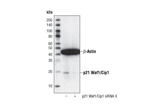 p21 Waf1/Cip1 (12D1) 兔單克隆抗體,p21 Waf1/Cip1 (12D1) Rabbit mAb