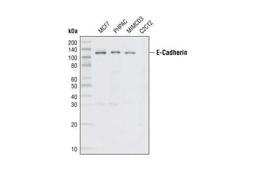 E-鈣粘蛋白（24E10）兔單克隆抗體,E-Cadherin (24E10) Rabbit mAb