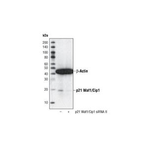 p21 Waf1/Cip1 (12D1) 兔單克隆抗體,p21 Waf1/Cip1 (12D1) Rabbit mAb