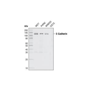 E-鈣粘蛋白（24E10）兔單克隆抗體,E-Cadherin (24E10) Rabbit mAb