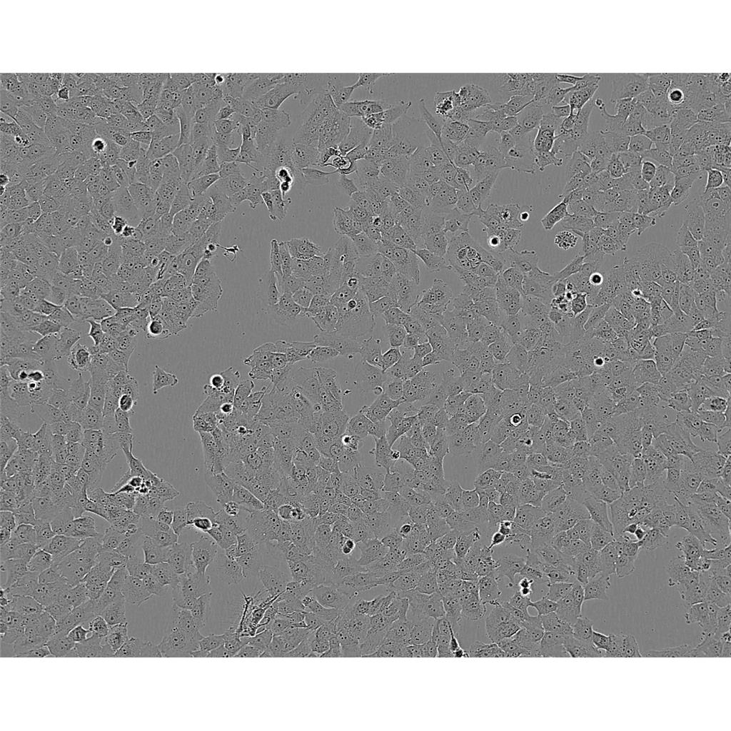 NCI-H1792 Cells#人肺腺癌細(xì)胞系低代次|培養(yǎng)基|贈STR圖譜,NCI-H1792 Cells#