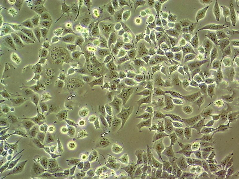 MeWo Cells#人惡性黑色素瘤細(xì)胞系低代次|培養(yǎng)基|贈(zèng)STR圖譜,MeWo Cells#