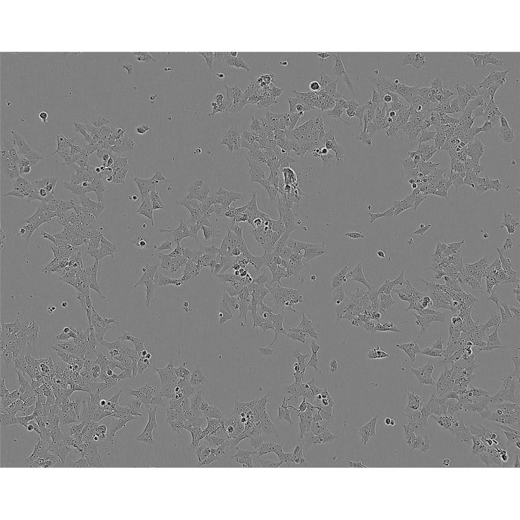 NCI-H1563 Cells#人非小細(xì)胞肺癌細(xì)胞系低代次|培養(yǎng)基|贈(zèng)STR圖譜,NCI-H1563 Cells#