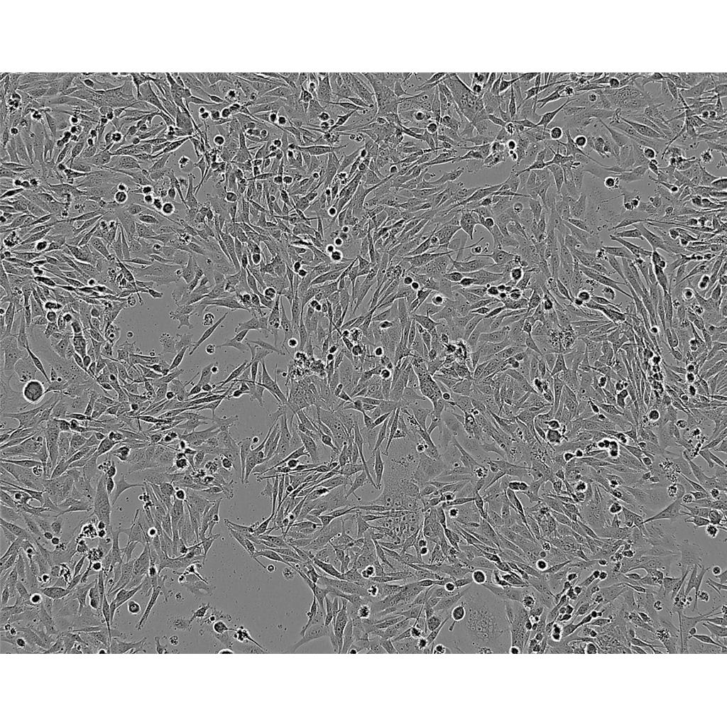 KYSE-410 Cells#人食管鱗癌細(xì)胞系低代次|培養(yǎng)基|贈STR圖譜,KYSE-410 Cells#