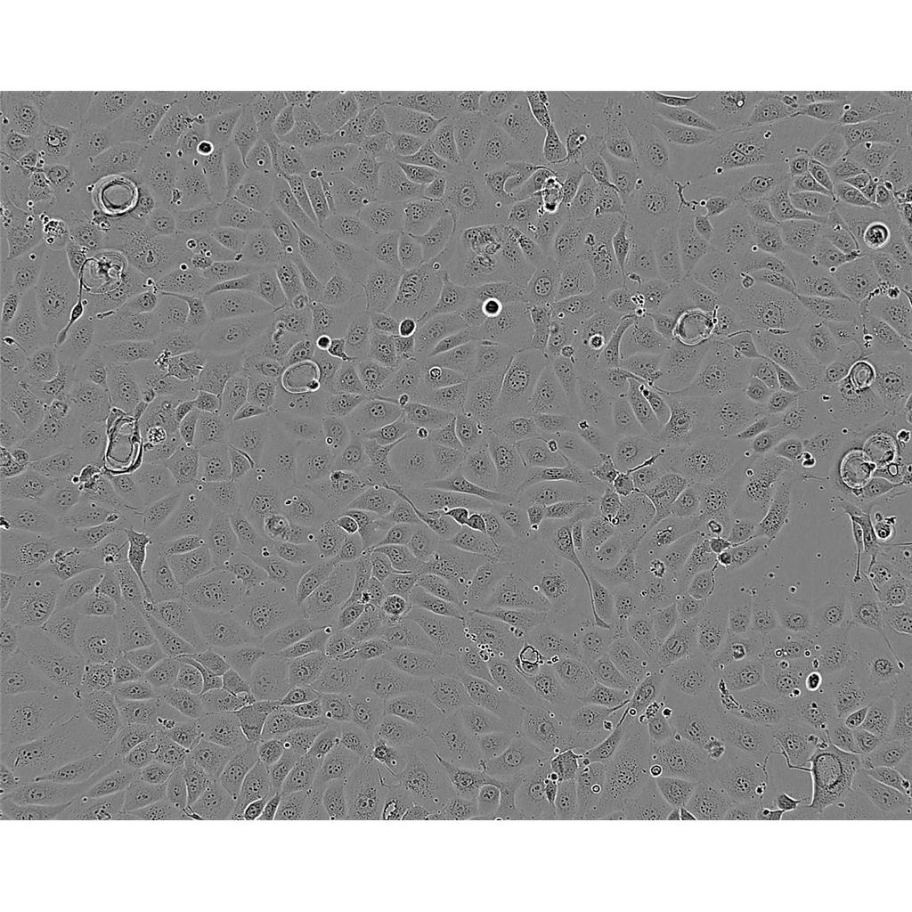 MDA-MB-361 Cells#人乳腺癌細(xì)胞系低代次|培養(yǎng)基|贈(zèng)STR圖譜,MDA-MB-361 Cells#