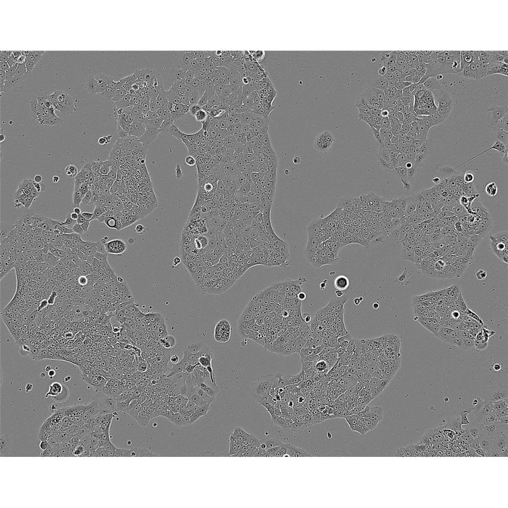 NCI-H2170 Cells#人肺鱗癌細(xì)胞系低代次|培養(yǎng)基|贈(zèng)STR圖譜,NCI-H2170 Cells#