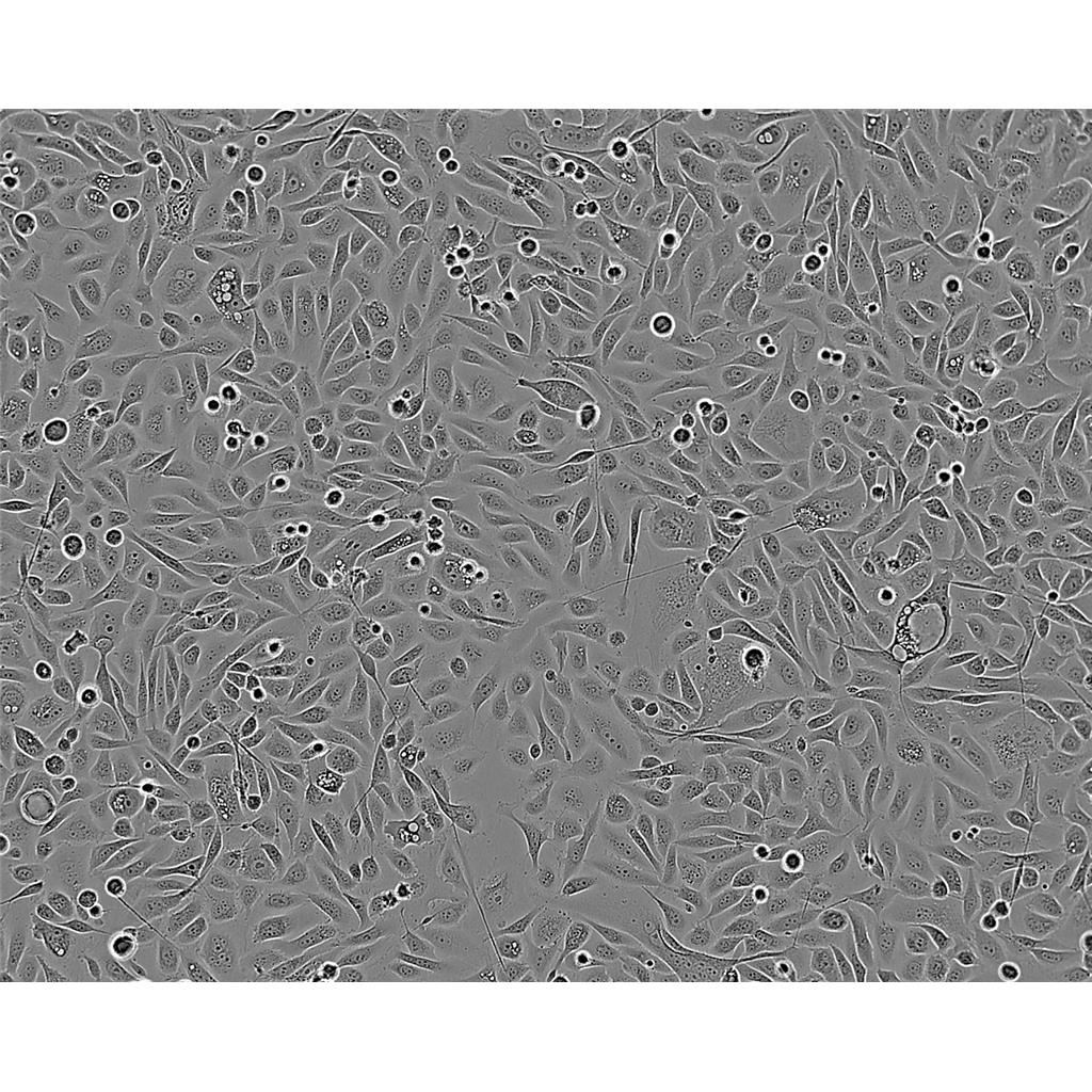 NCI-H1975 Cells#人肺腺癌細胞系低代次|培養(yǎng)基|贈STR圖譜,NCI-H1975 Cells#