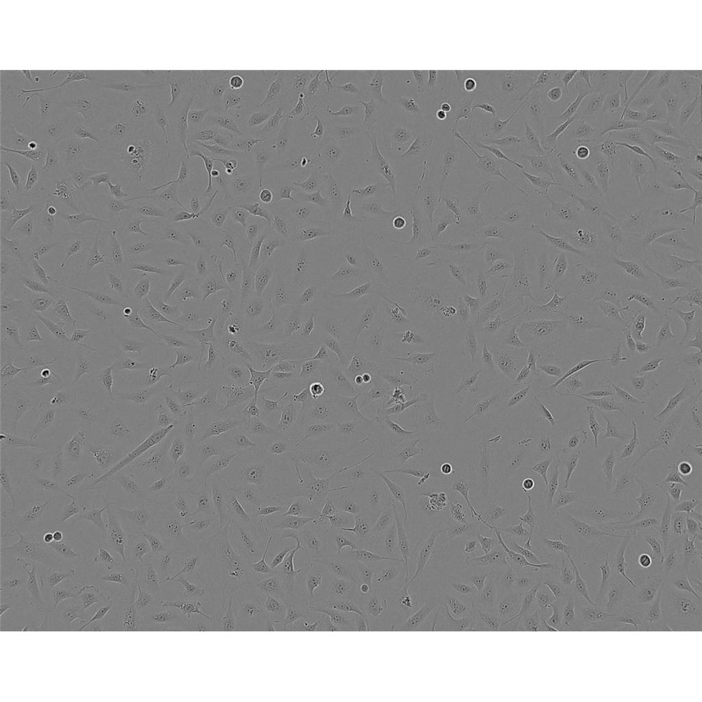 SK-OV-3 Cells#人卵巢癌細胞系低代次|培養(yǎng)基|贈STR圖譜,SK-OV-3 Cells#