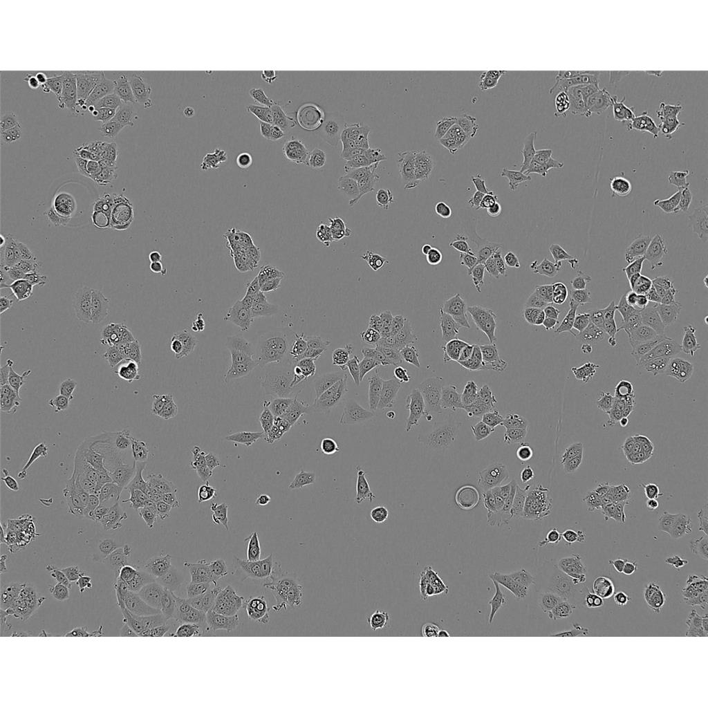 SK 1 Cells#人皮肤黑色素瘤细胞系来源可靠|培养基|带STR基因图谱,SK 1 Cells#