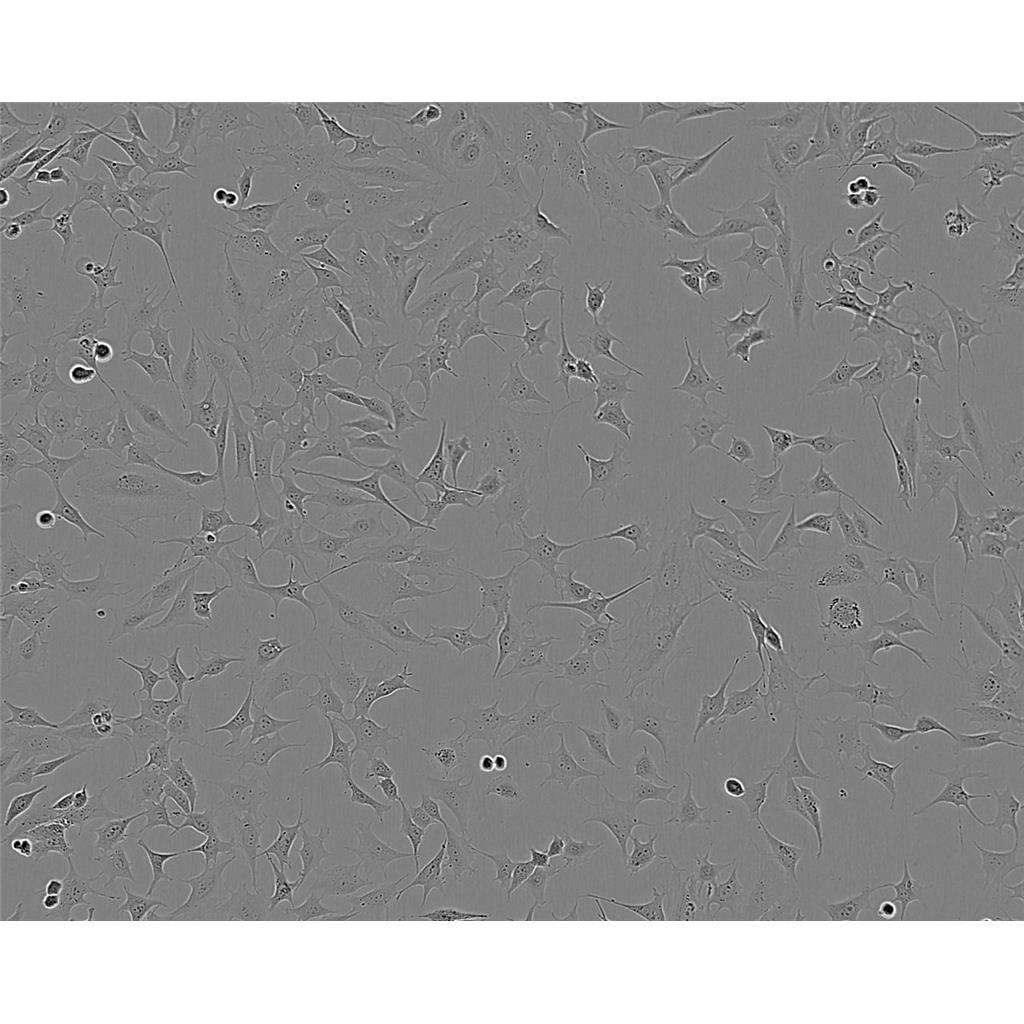 mda-468 Cells#人乳腺癌細(xì)胞系來(lái)源可靠|培養(yǎng)基|帶STR基因圖譜,mda-468 Cells#