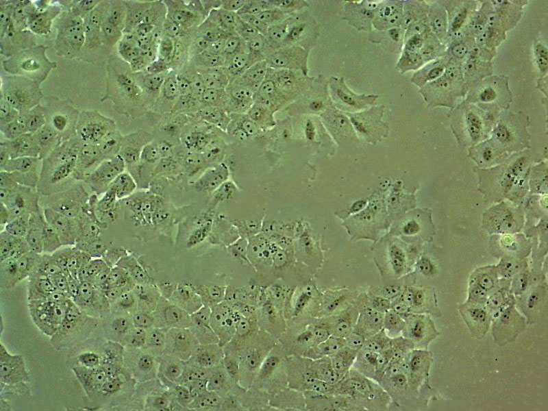 NCIH520 Cells#人肺腺鱗癌細胞系來源可靠|培養(yǎng)基|帶STR基因圖譜,NCIH520 Cells#